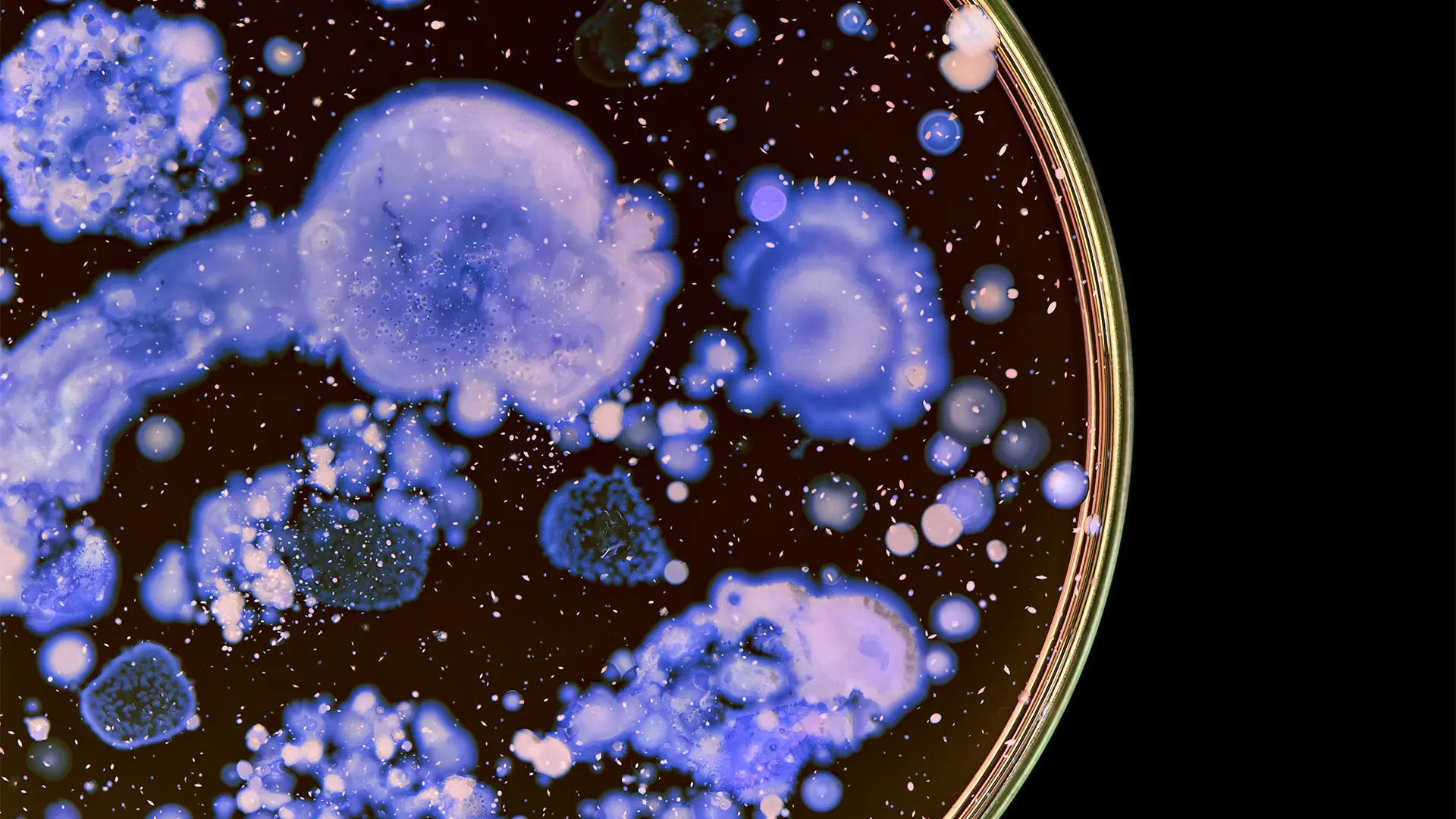 Superbugs like Methicillin-resistant MRSA, multidrug-resistant Mycobacterium tuberculosis and resistant strains of salmonella and E. coli are a growing risk to public health. Photo by Adobe Stock.